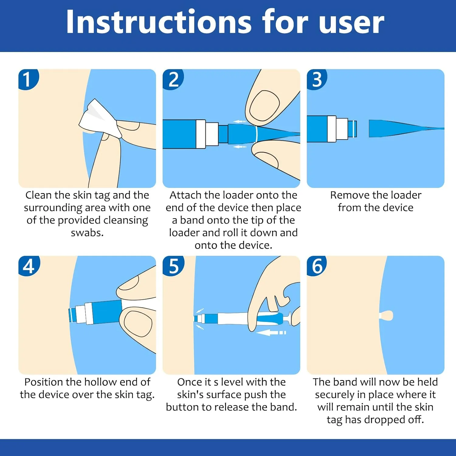 اداة إزالة الثآليل والزوائد الجلدية بسهولة